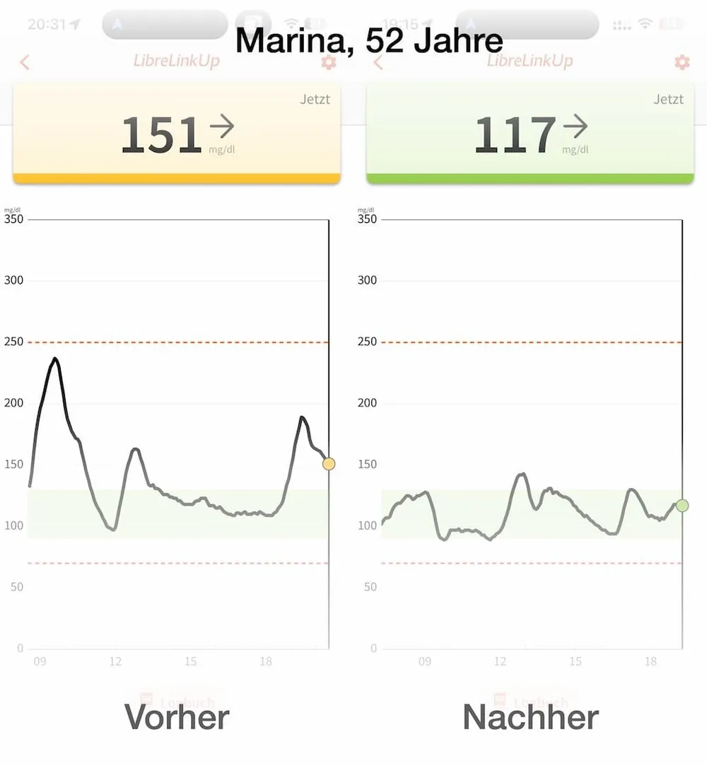 Blutzuckerkurve Marina – Vorher/Nachher Vergleich